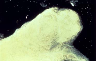 Andres Serrano. Frozen Sperm I